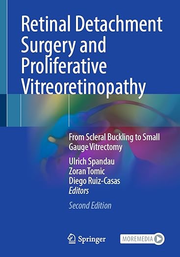 Retinal Detachment Surgery and Proliferative Vitreoretinopathy: From Scleral Buckling to Small Gauge Vitrectomy 2nd ed. 2022 Edition