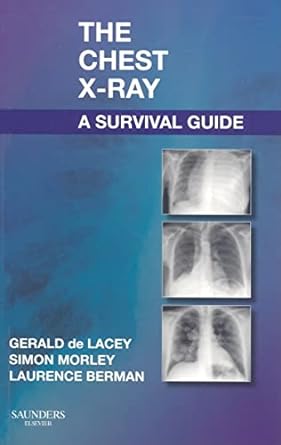The Chest X-Ray: A Survival Guide 1st Edition