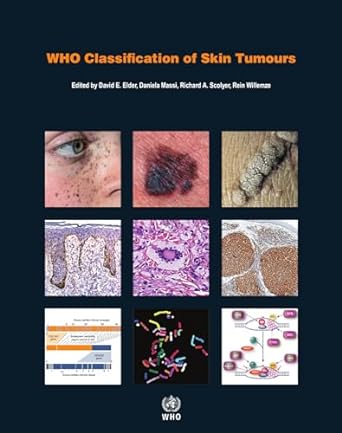 WHO Classification of Skin Tumours 4th Edition