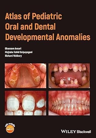 Atlas of Pediatric Oral and Dental Developmental Anomalies 1st Edition