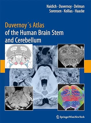 Duvernoy’s Atlas of the Human Brain Stem and Cerebellum