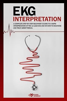 Ekg Interpretation: A complete step-by-step beginner's guide to a rapid interpretation of the 12-lead EKG and on how to diagnose and treat arrhythmias