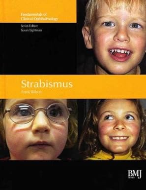 Strabismus: Fundamentals of Clinical Opthalmology 1st Edition